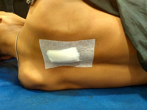 Dua Remaja Dianiaya Orang Tak Dikenal 1 5 aniaya 3klm gabung 1