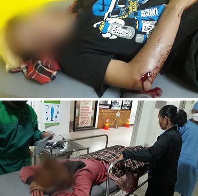 Dua Remaja Dianiaya Segerombolan Orang tak Dikenal 1 5 remaja 4klm