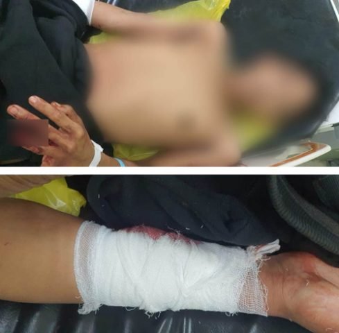 Diserang Orang Tak Dikenal saat Nongkrong 1 6 Diserang 3klm
