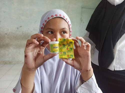 Puskesmas Periksa Siswa Penderita Scabies<br>Di SDN Kelayan Selatan 1 1 hal9 3klmscabies