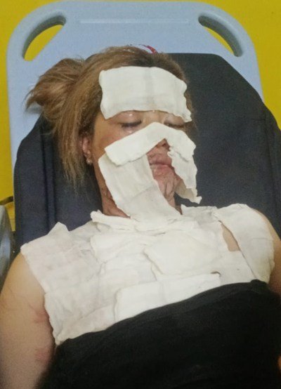 5 HL dibakar pacar 3 klm