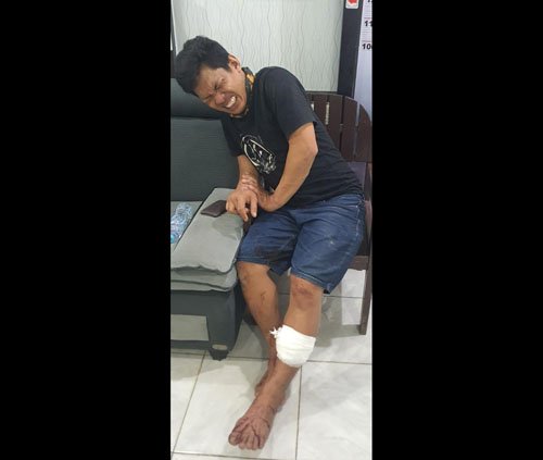 5 HL Pembakar Pacar Didor 3klm