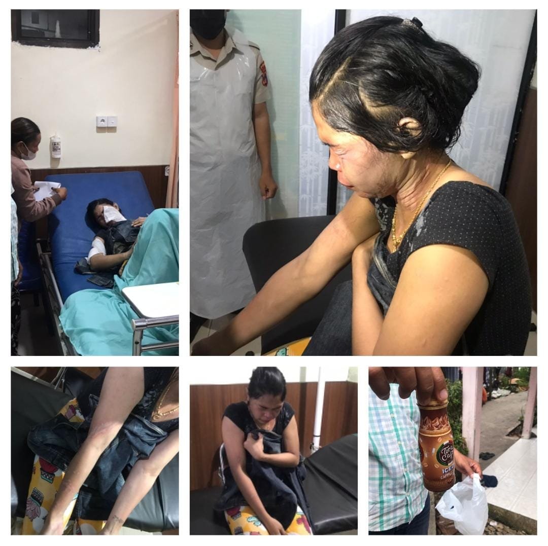 Dibakar Api Cemburu, Alam Siram Air Keras ke Wajah Kekasih 1 IMG 20230421 WA0027