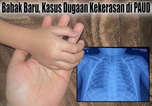 1 utama 5 klm ljt paud