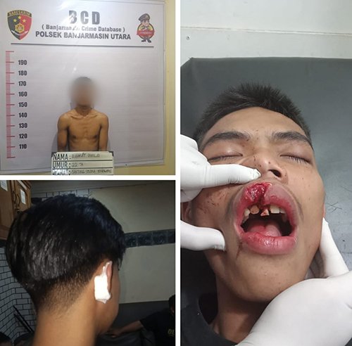 5 Cekcok di Kampus 3klm