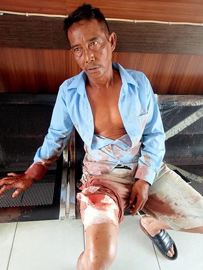 Pesta Miras Oplosan Berakhir Perkelahian 1 5 Pesta Miras Oplosan 2klm