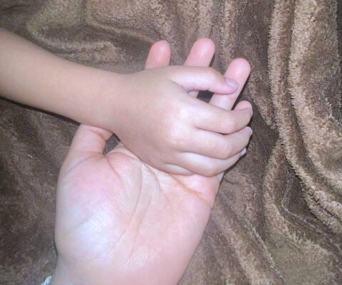 Orang Tua Korban Tegaskan Tempuh Jalur Hukum, Walikota Minta PAUD Pasang CCTV