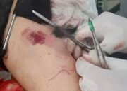 Gara-Gara Ini, Istri Muda Ditusuk Suami Hingga Dilarikan ke Rumah Sakit