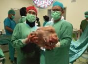 Respons Cepat Wali Kota Banjarbaru Selamatkan Warga Pengidap Tumor Payudara