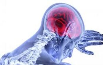 Gaya Hidup Hingga Riwayat Genetik Jadi Faktor Risiko Stroke 4 IMG 20260620 WA0029